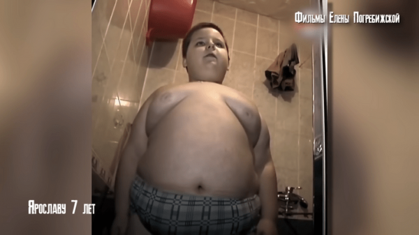 Как сейчас выглядит мальчик, который в 7 лет весил 80 кг, — его не узнать!